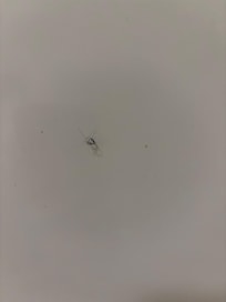 Pubic hair