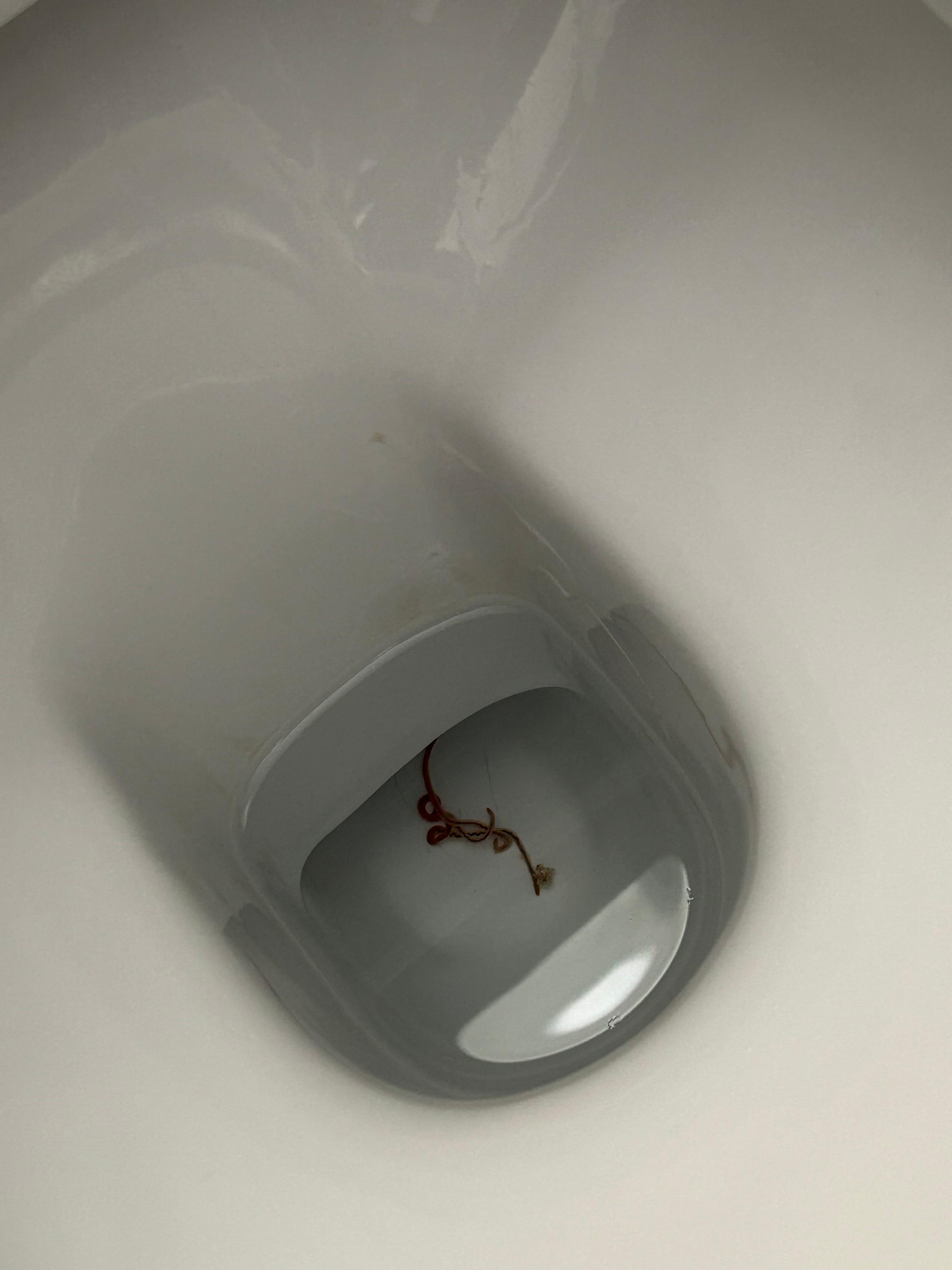 Live intestinal worms