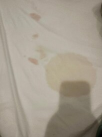 Blood stains?