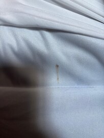 Blood on mattress pad