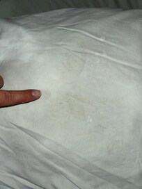 Stained sheets.