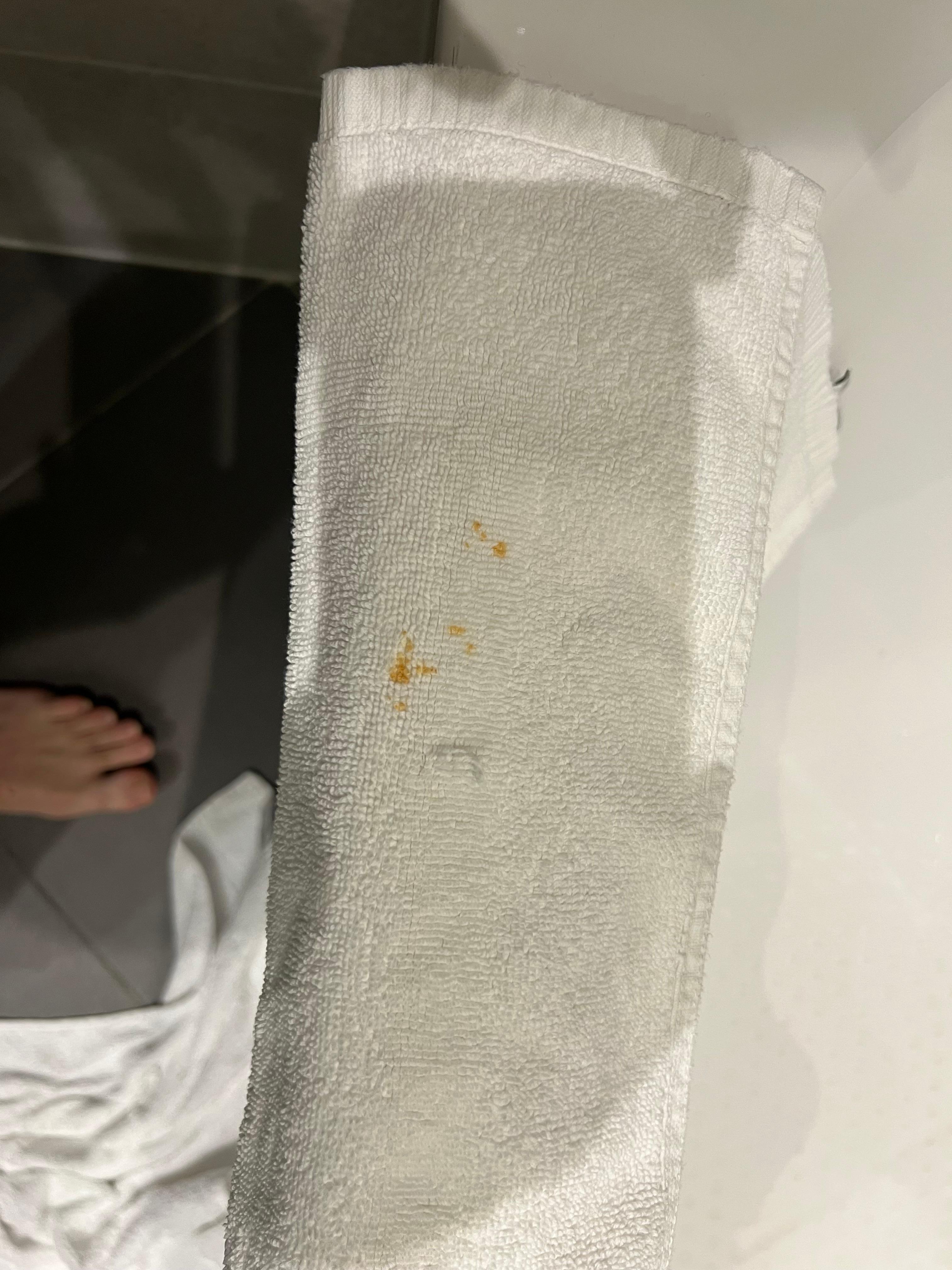 Stained bathroom towel