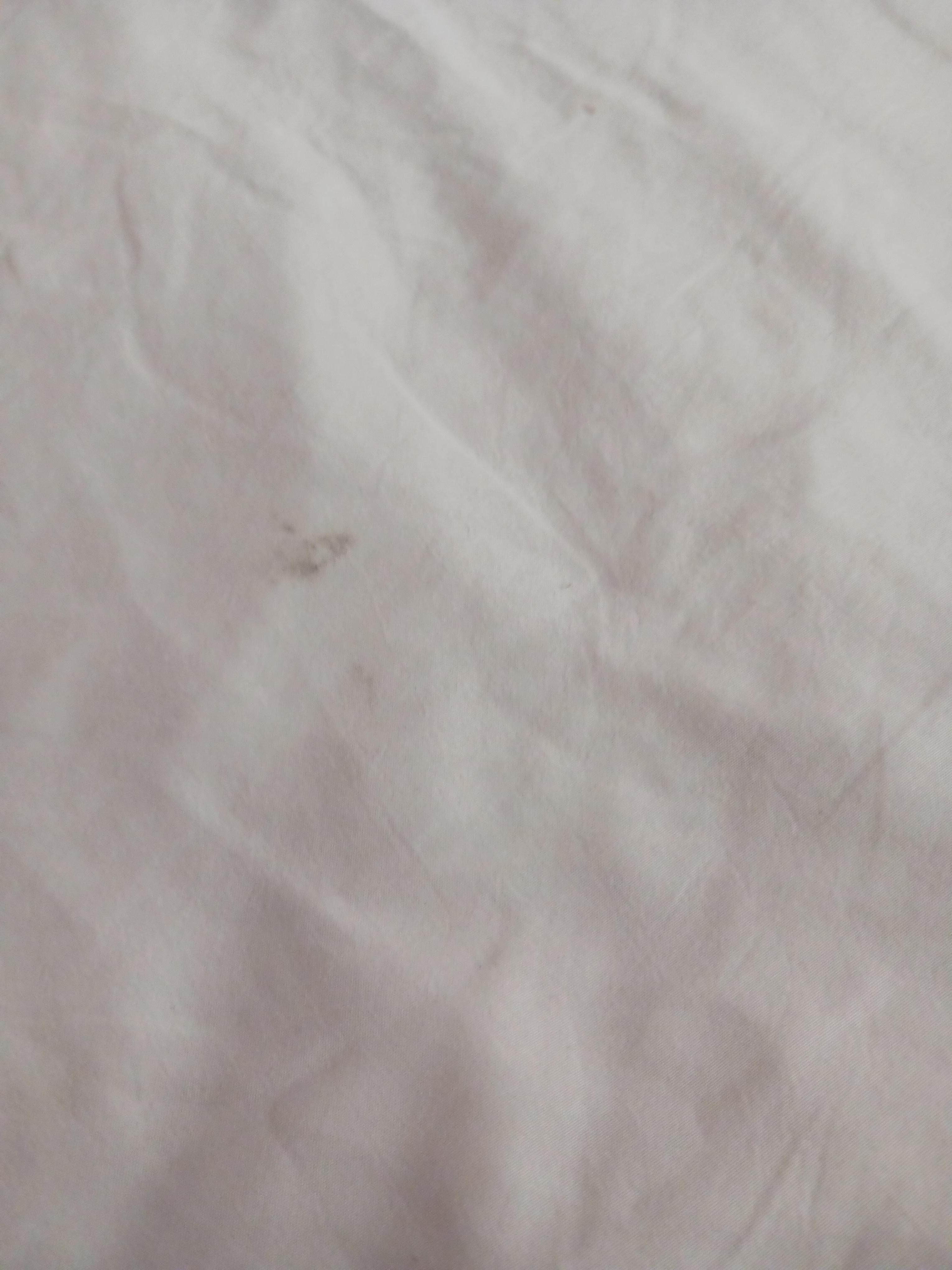 Stained sheets, also cigarette burns