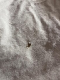 Cigarette burns hole in sheets