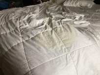 Yellow stain