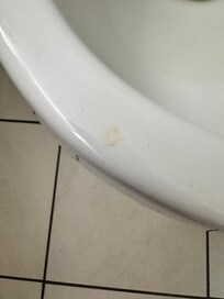 Urine stain on toilet