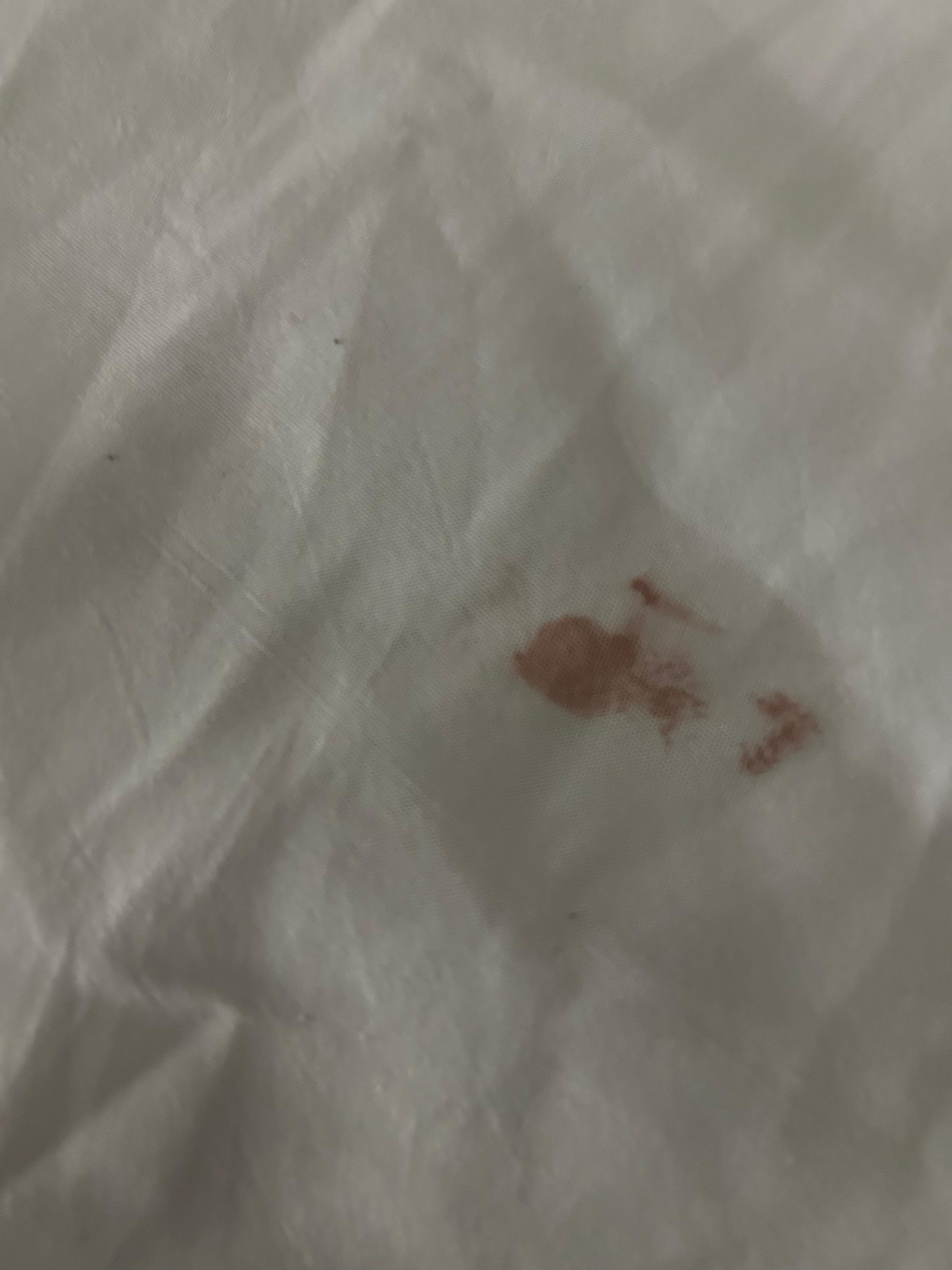 Dirty sheet near pillow area on sheet covering mattress 