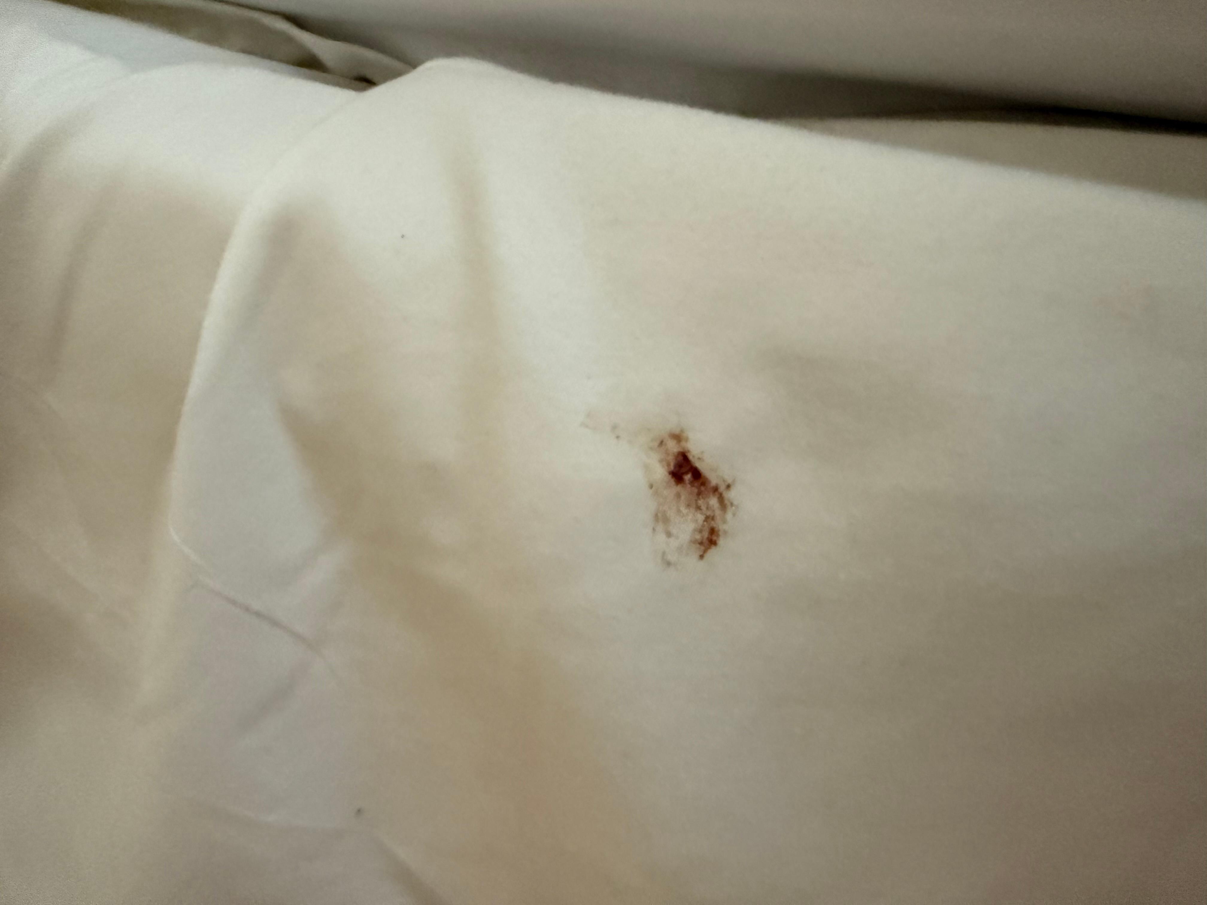 Blood on the bed sheet. 