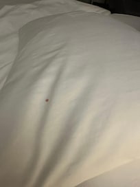 Bloody stained on the pillow sheet.