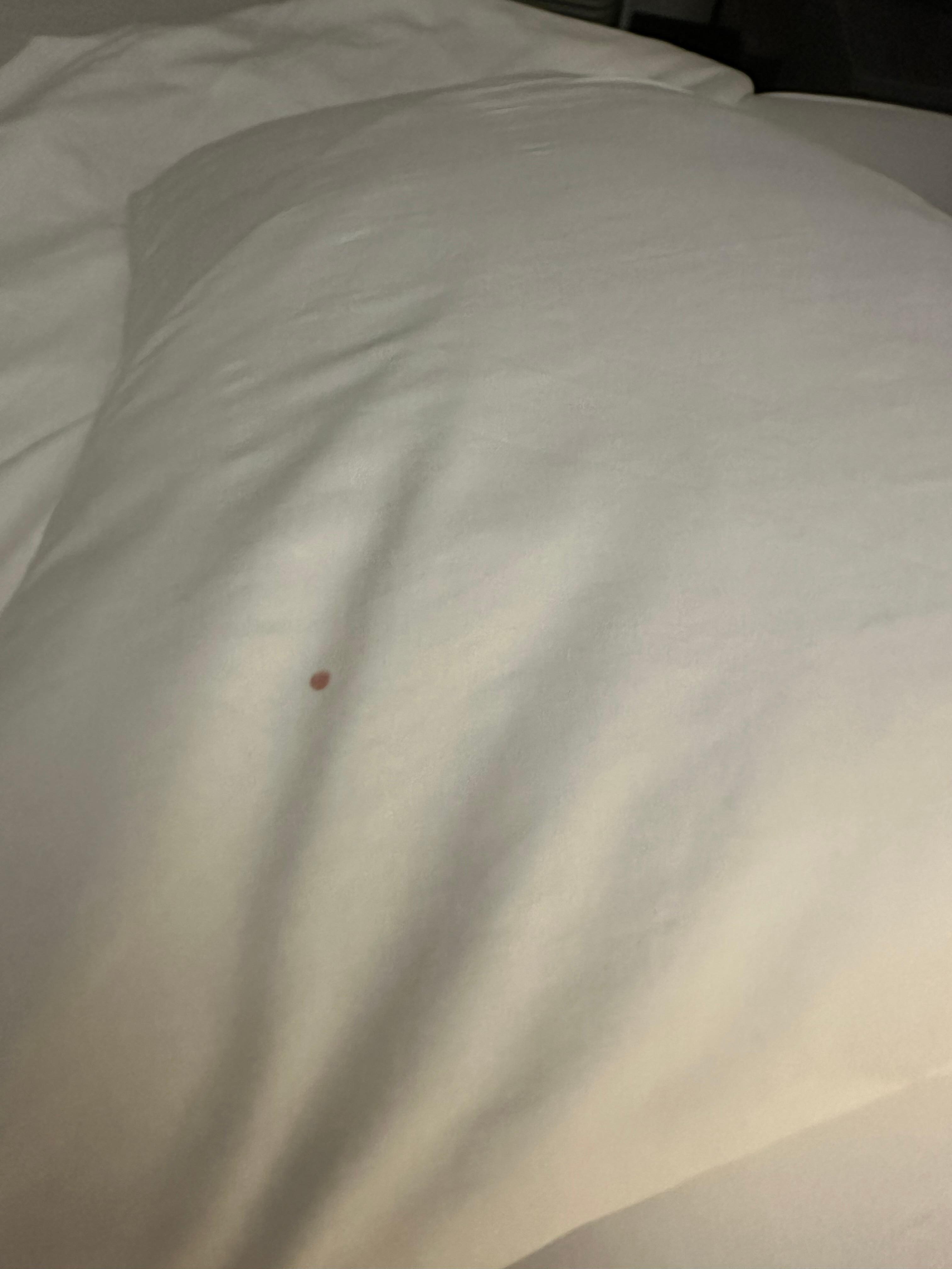 Bloody stained on the pillow sheet.