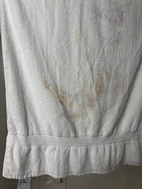 This was a “clean” towel given to us by the hotel. It was disgusting.