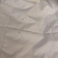 Blood stain in the sheets and cover look at this I just know I arrive and I wanted to show you blood in the sheets????