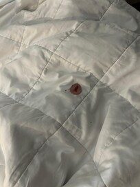 Blood on the blanket.