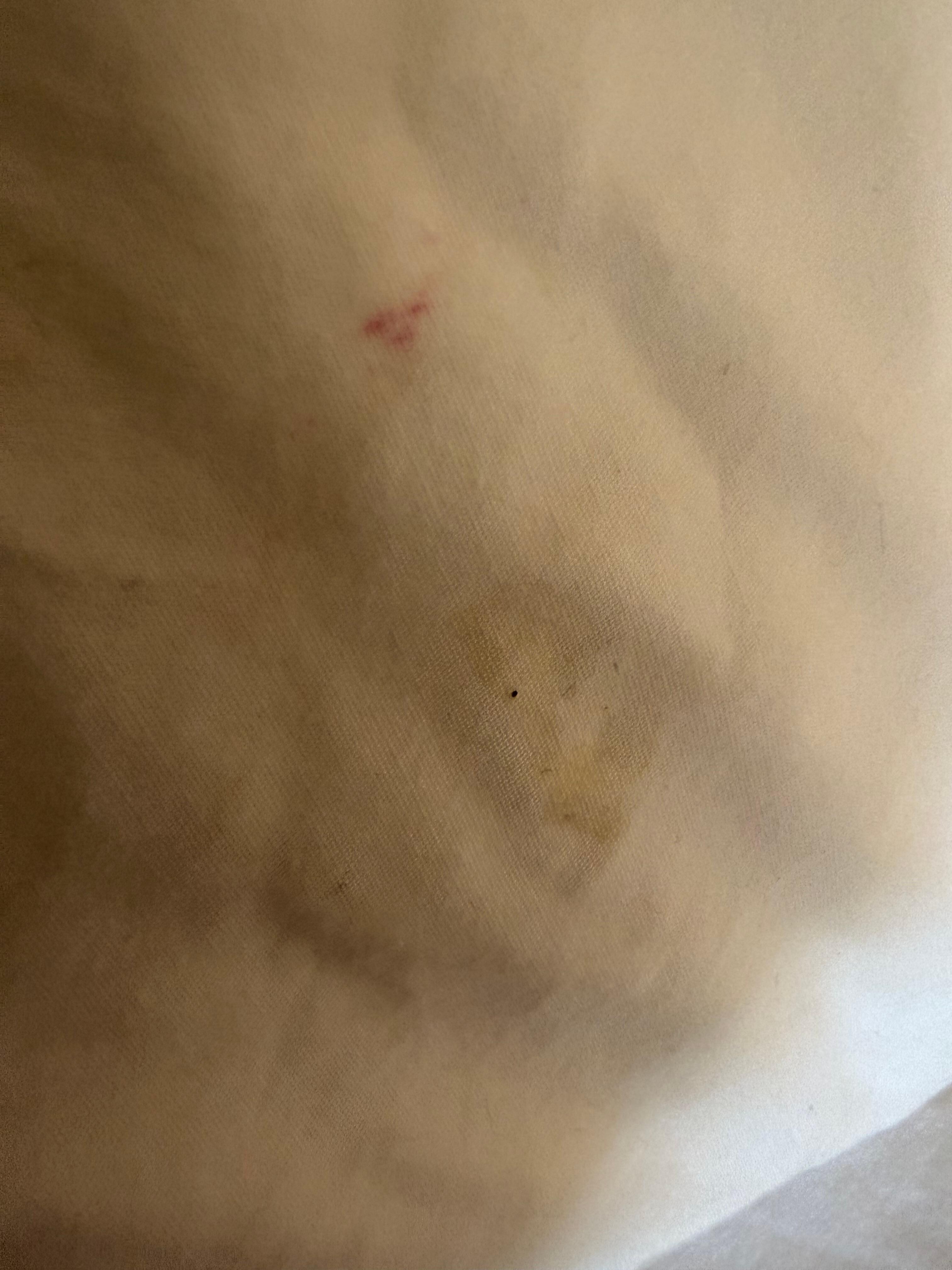 This pillowcase had a fresh stain on it, too. 