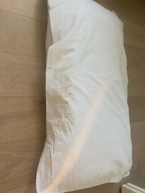 Mold on pillowcases