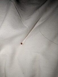 Bed bug on the bed and pillow
