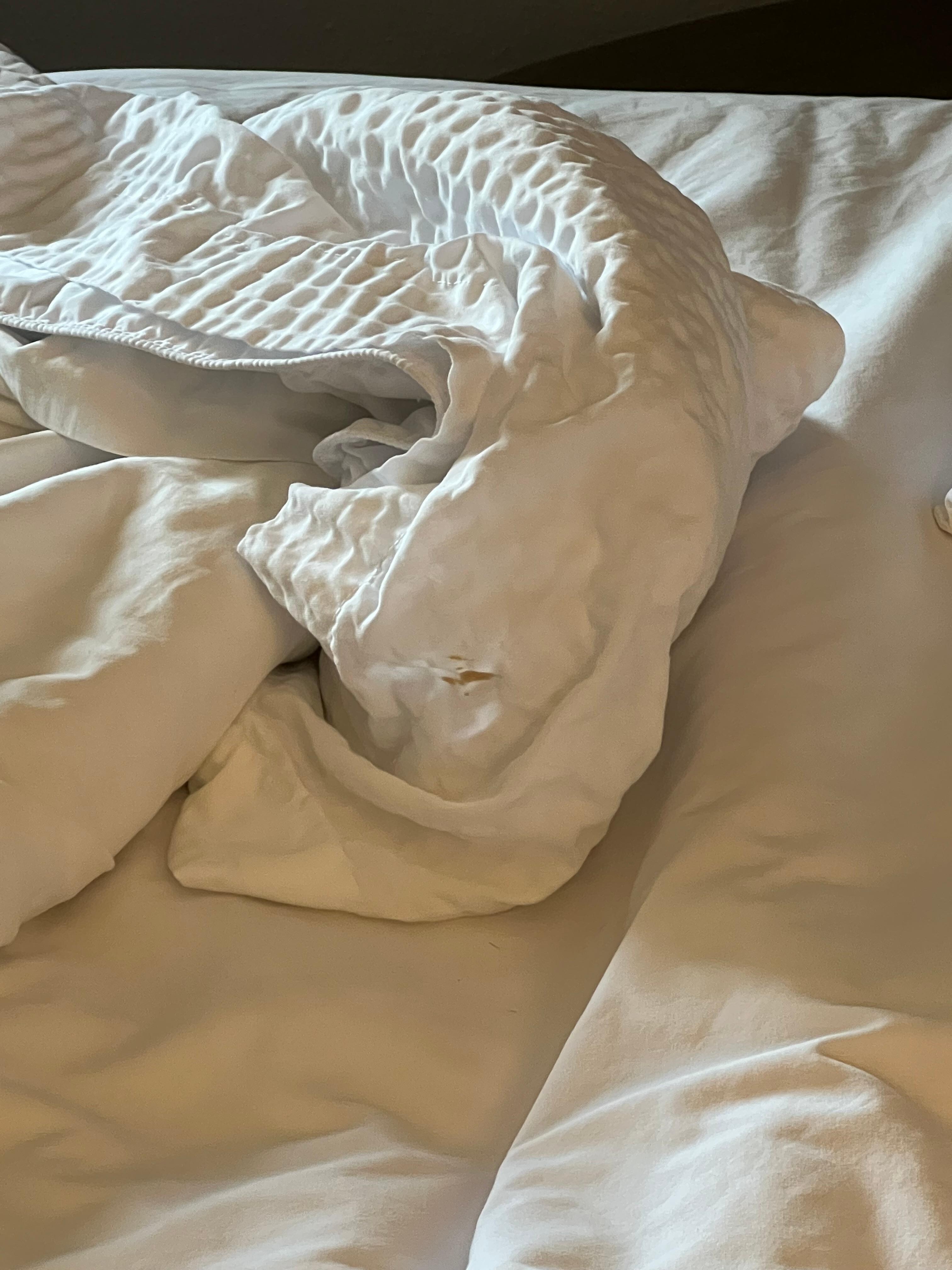 Stain on comforter/sheet. Anything stained should be thrown away. 