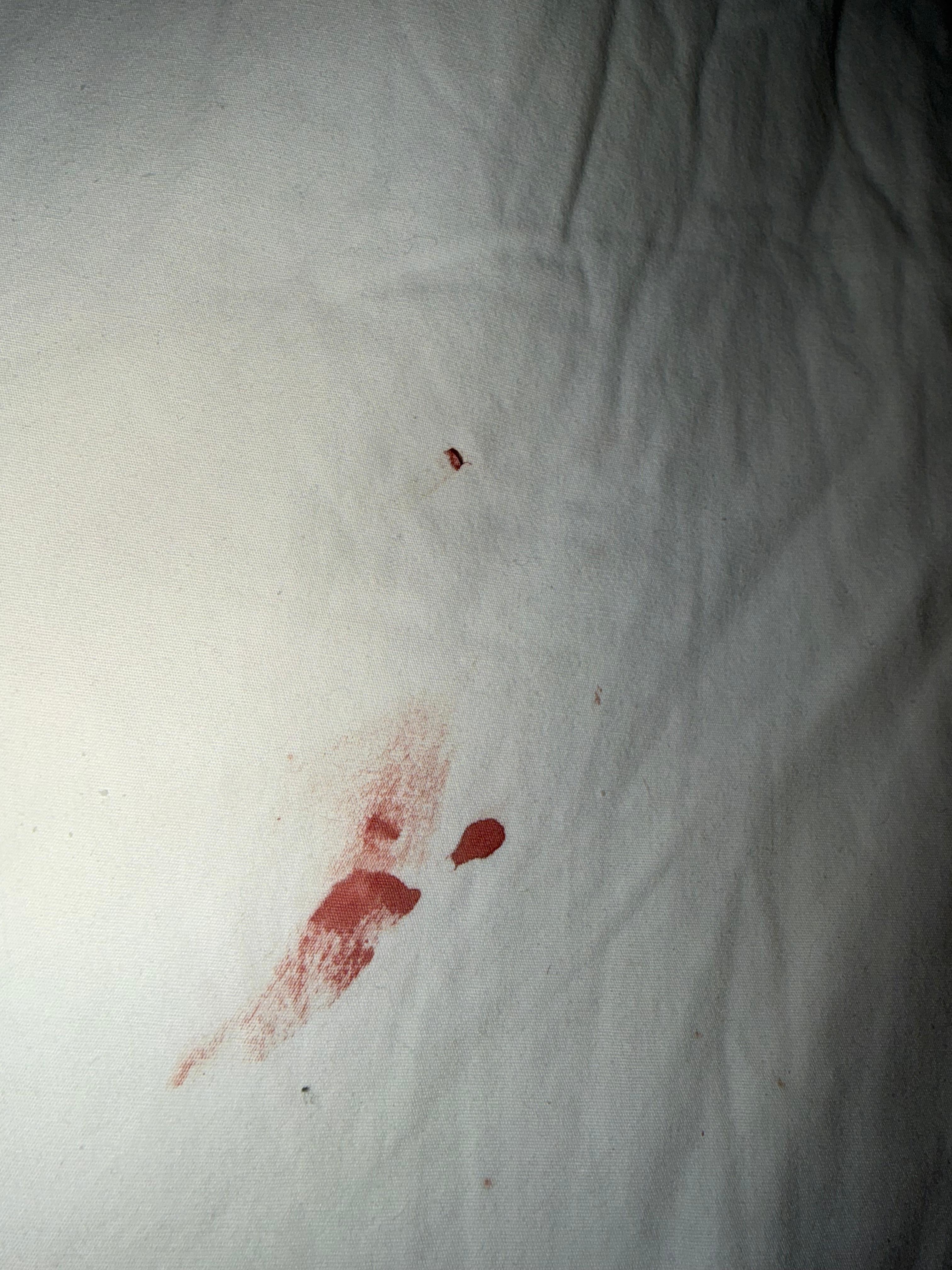 Blood on pillow