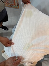 Yellow staining in the linens