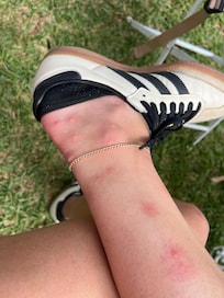 Got extremely bitten by the bugs with staying there one night