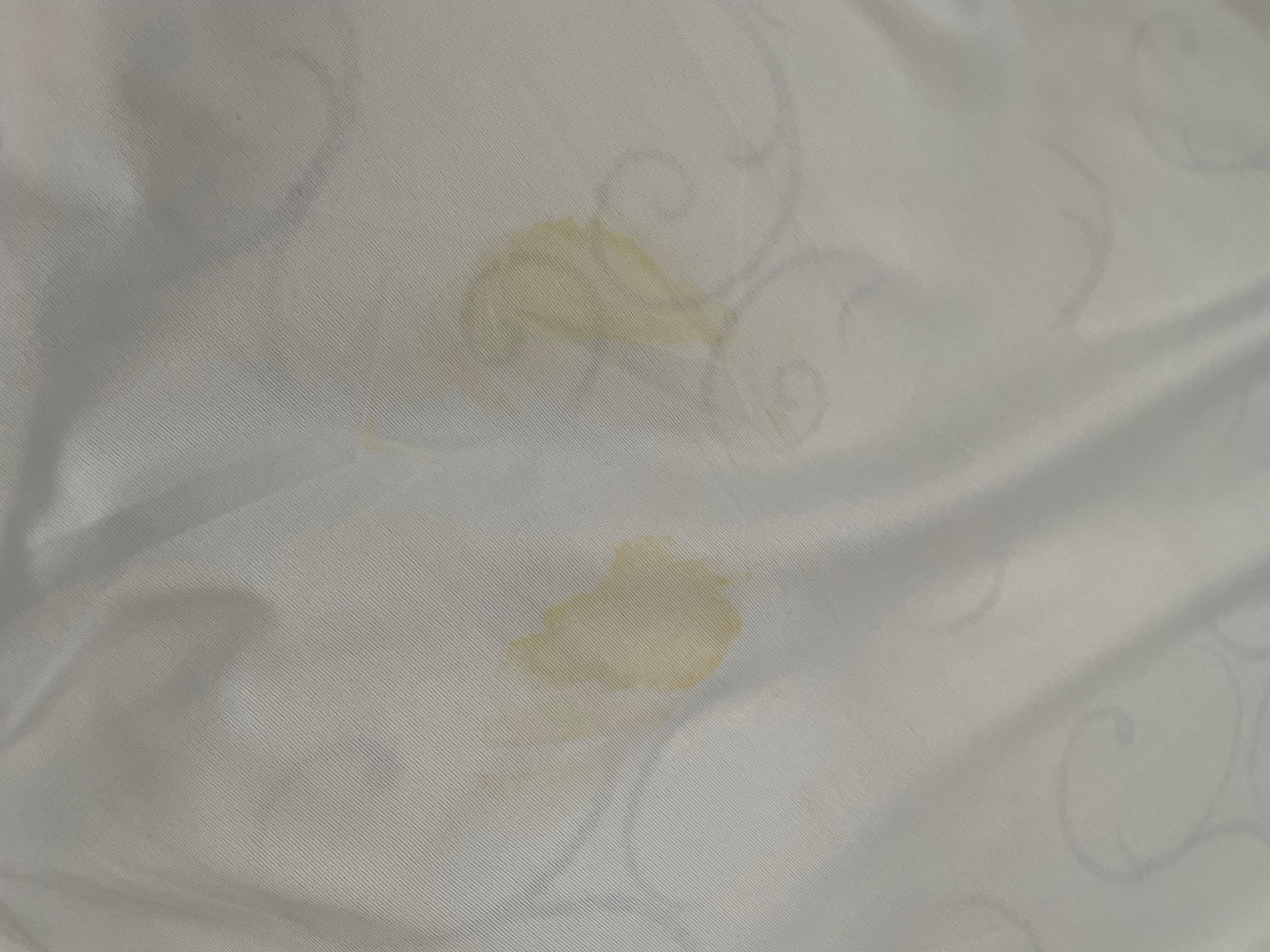 Stains on sheets