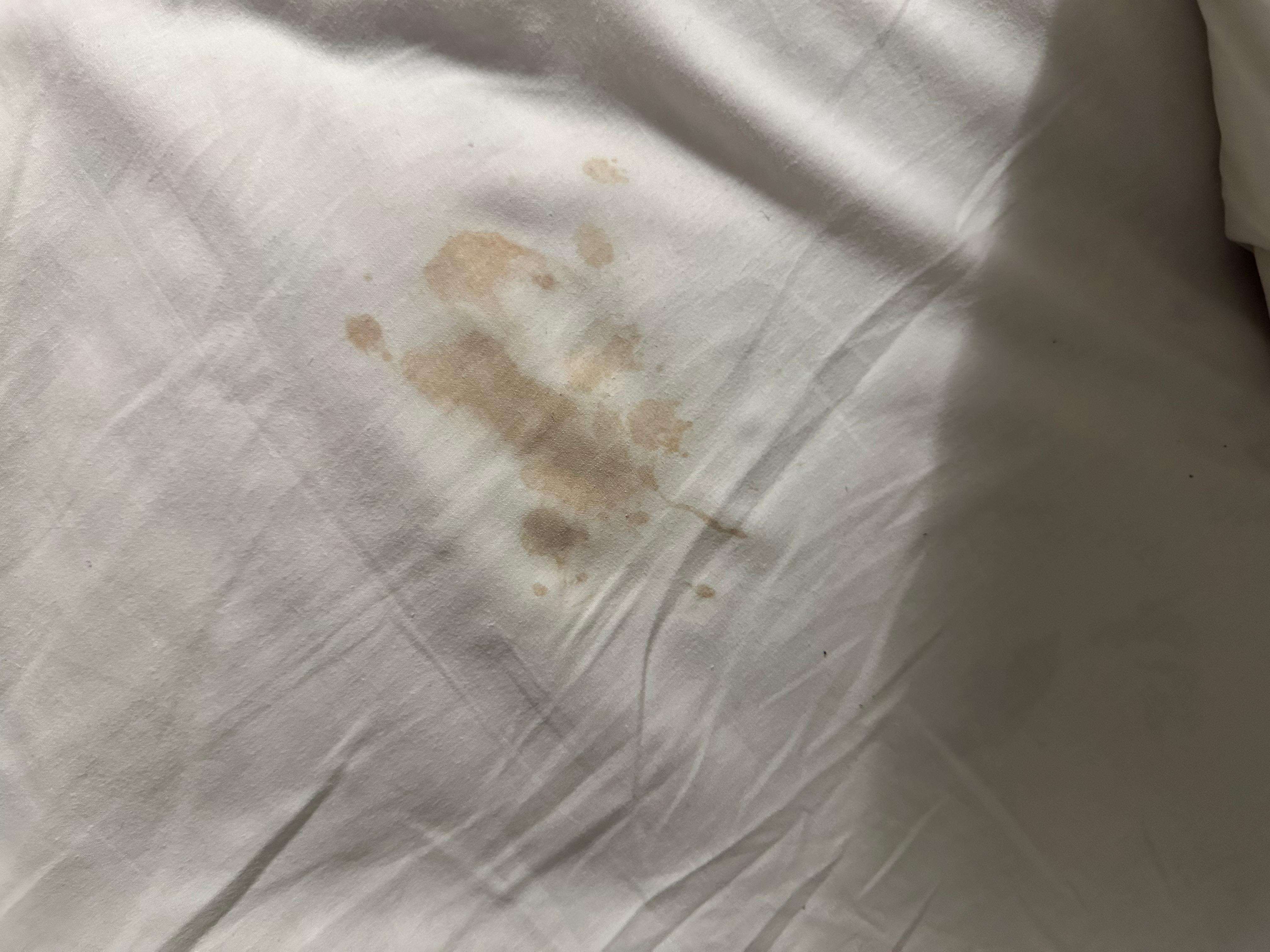 Stain on sheets