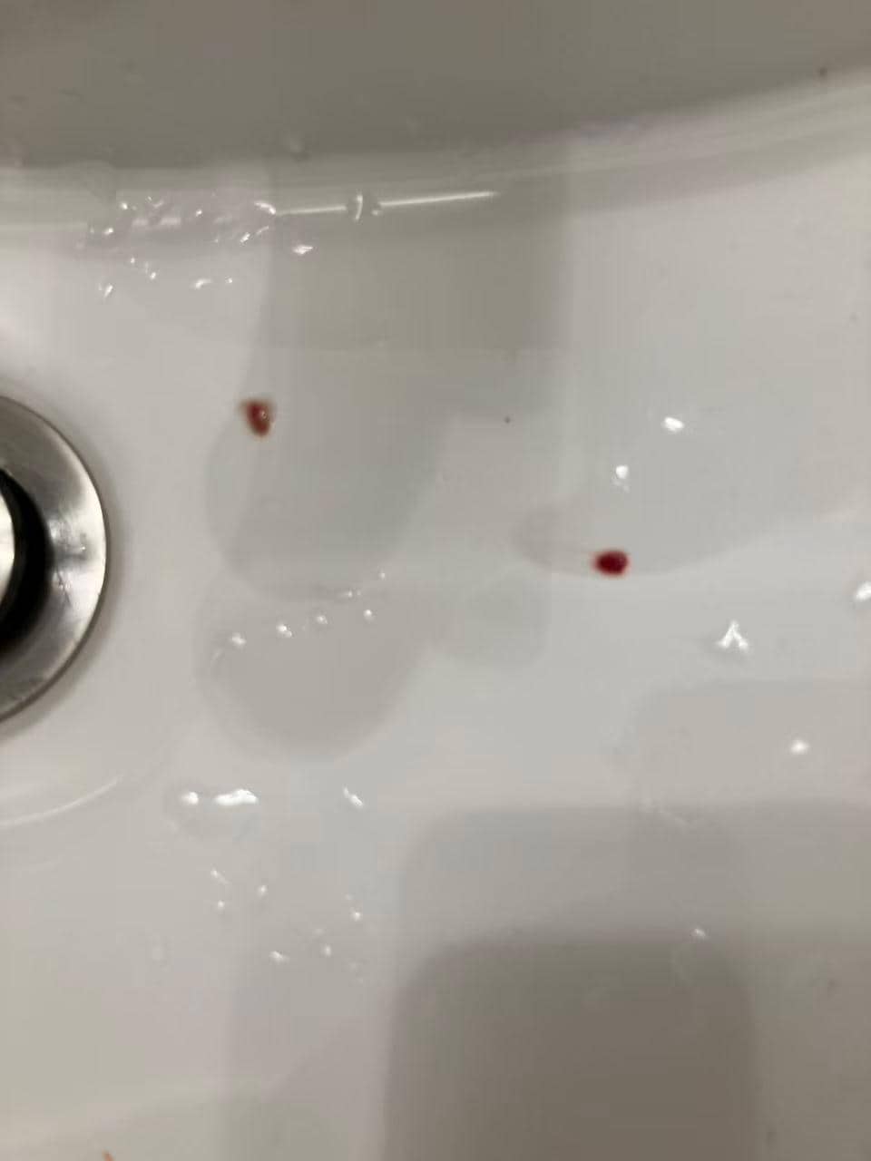 The poor air quality in the room made my throat itchy the next day, and I even coughed up blood.