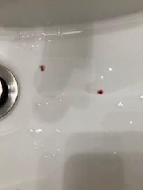 The poor air quality in the room made my throat itchy the next day, and I even coughed up blood.