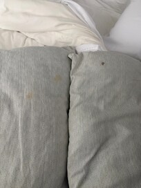 Examples of blood stains on pillows. The pillows were also flat and old. There were also blood stains on mattress toppers.