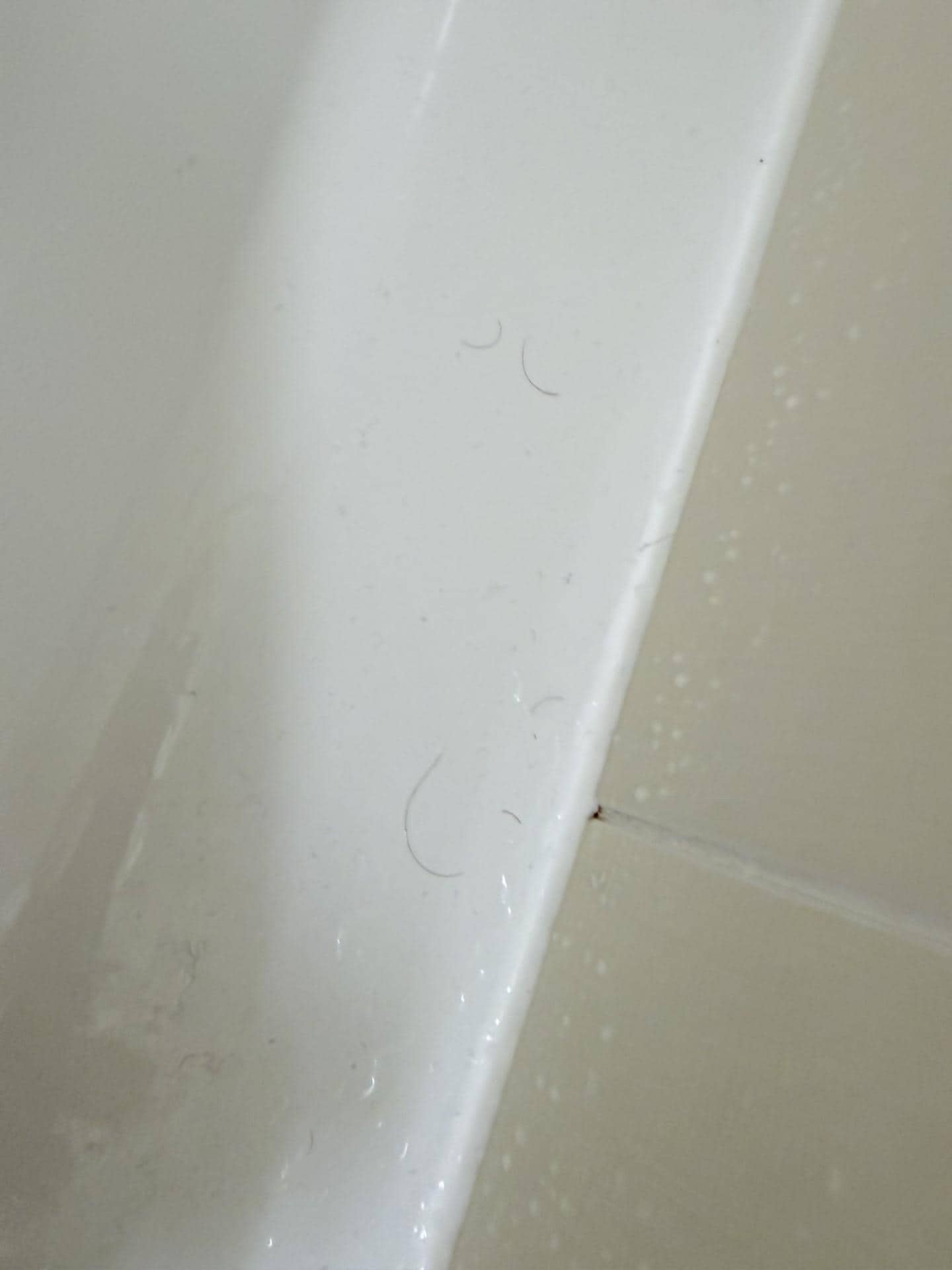 Black Hairs around the bathroom 2