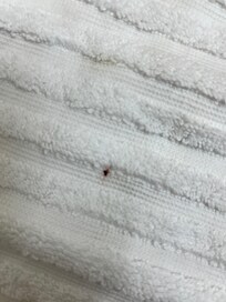 Bugs