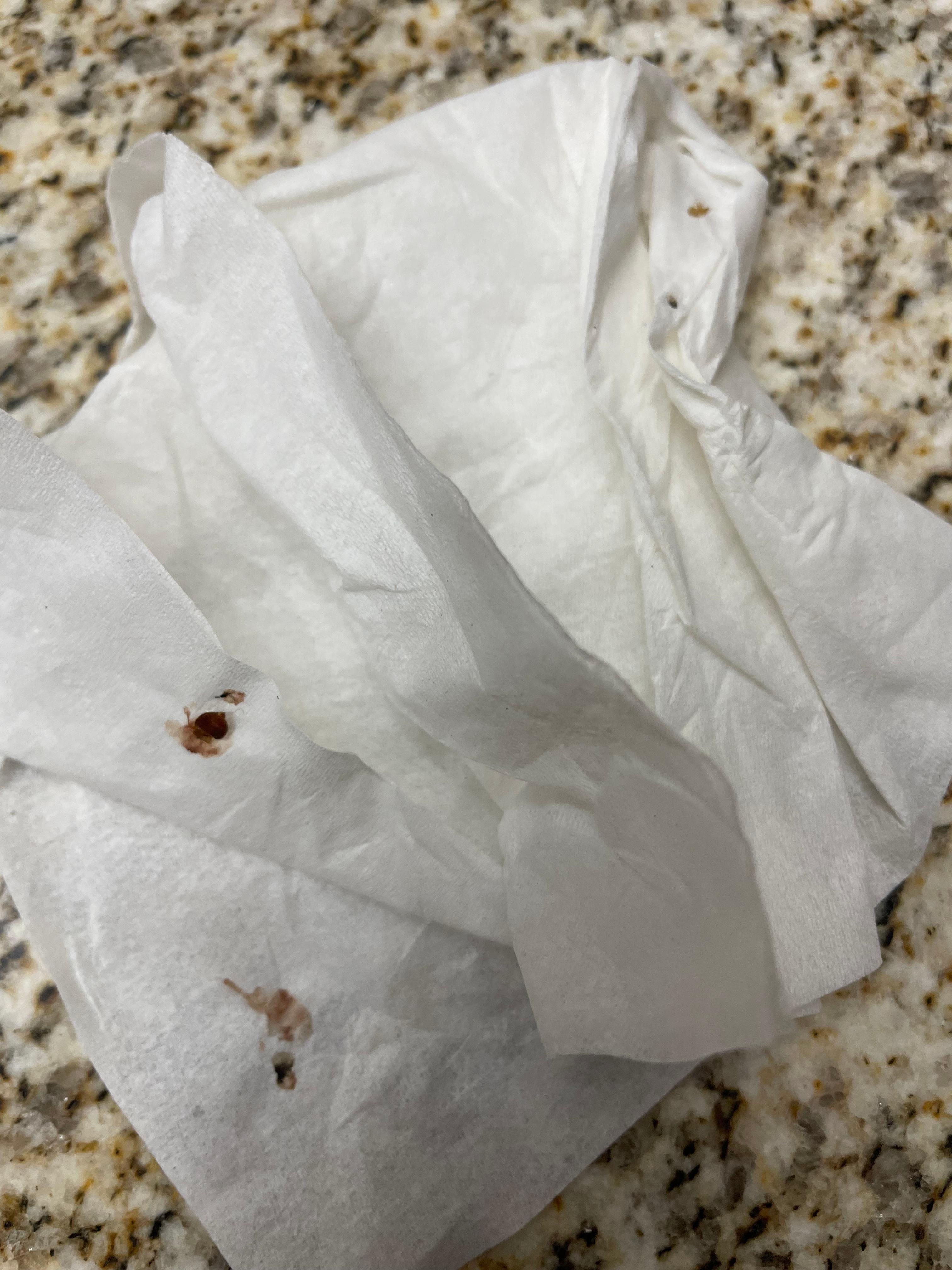 Some of the bedbugs we squashed from our beds.
