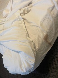 Stains on bedding