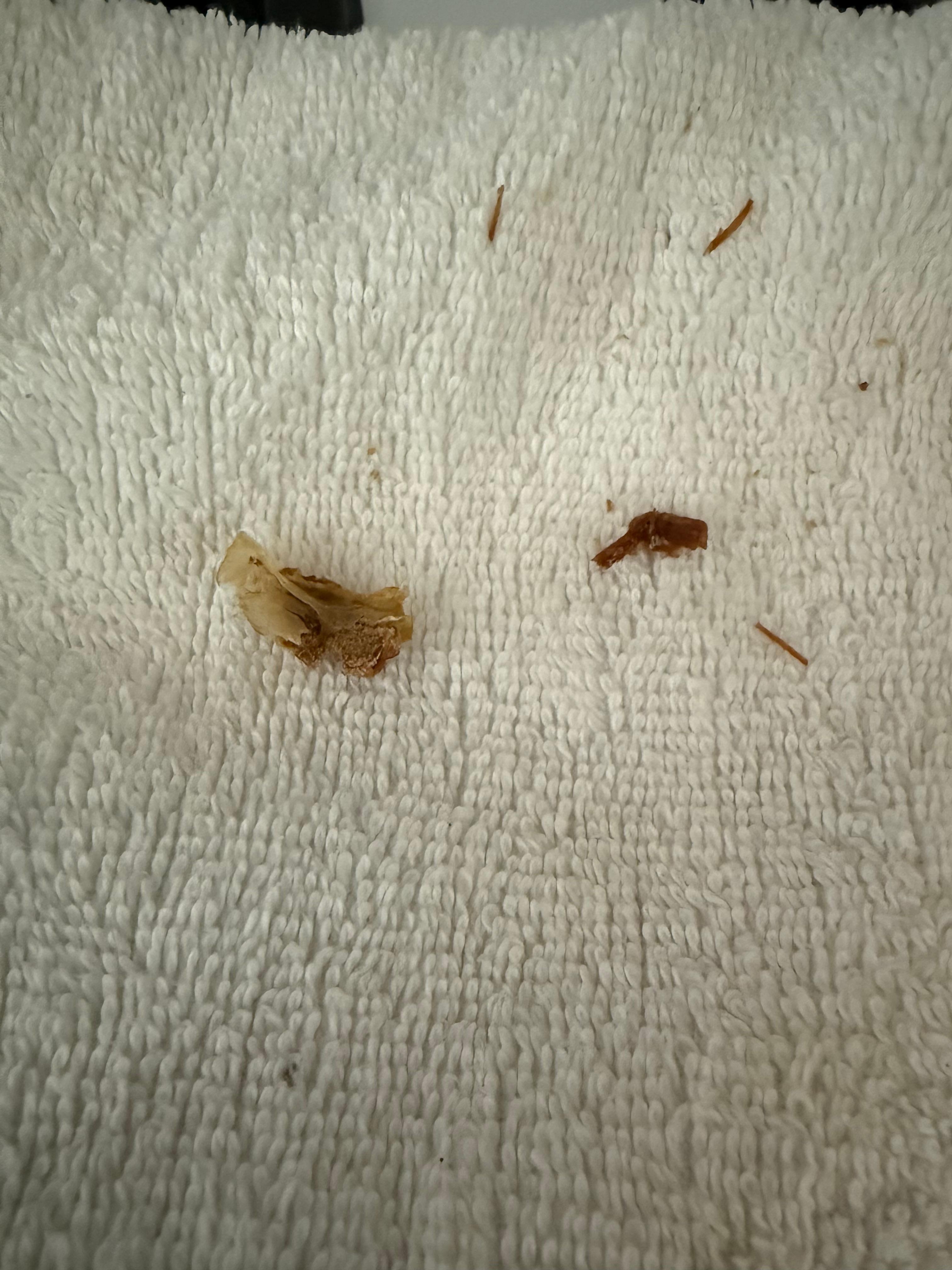 Stuff on dresser handles. Not exactly sure what it was. But it was disgusting