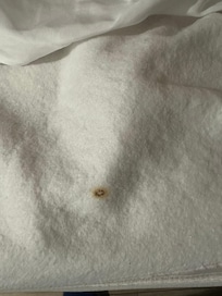 Cig burns