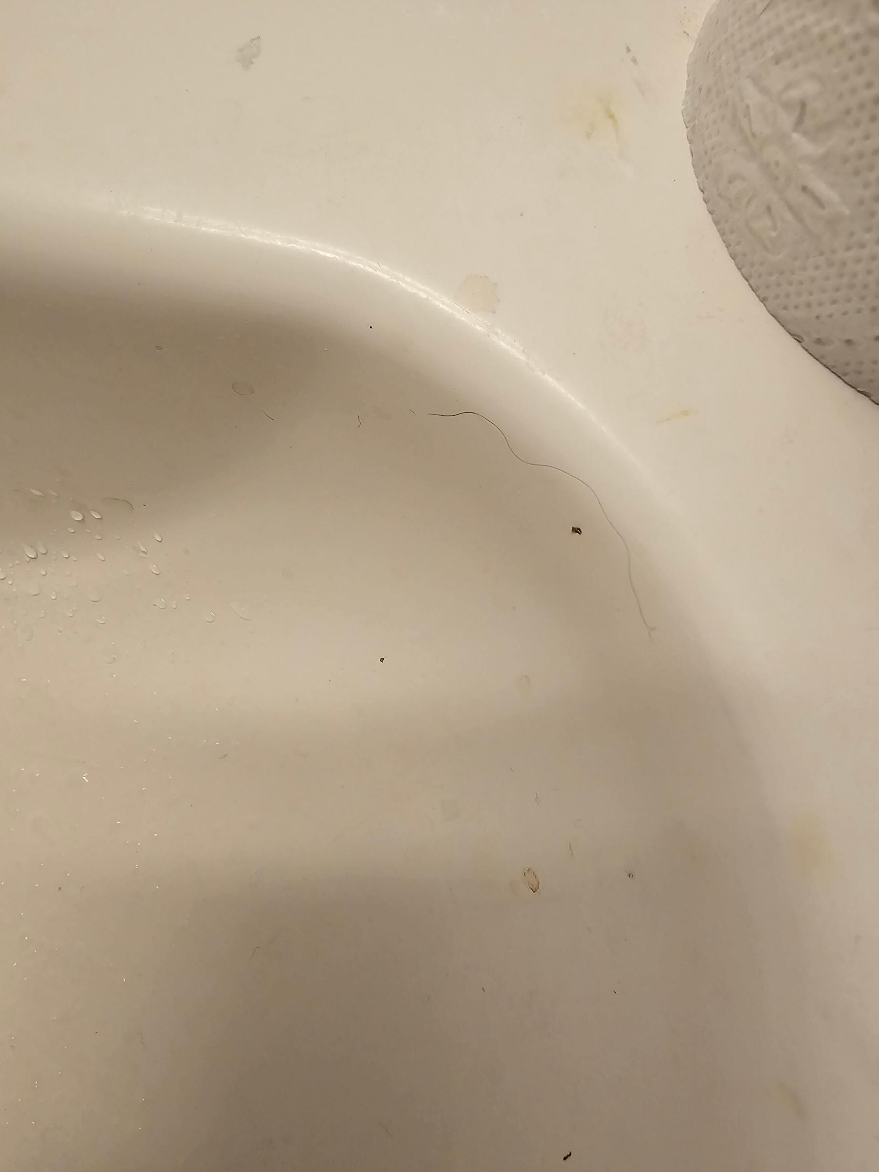 Blood and hair on uncleaned sink