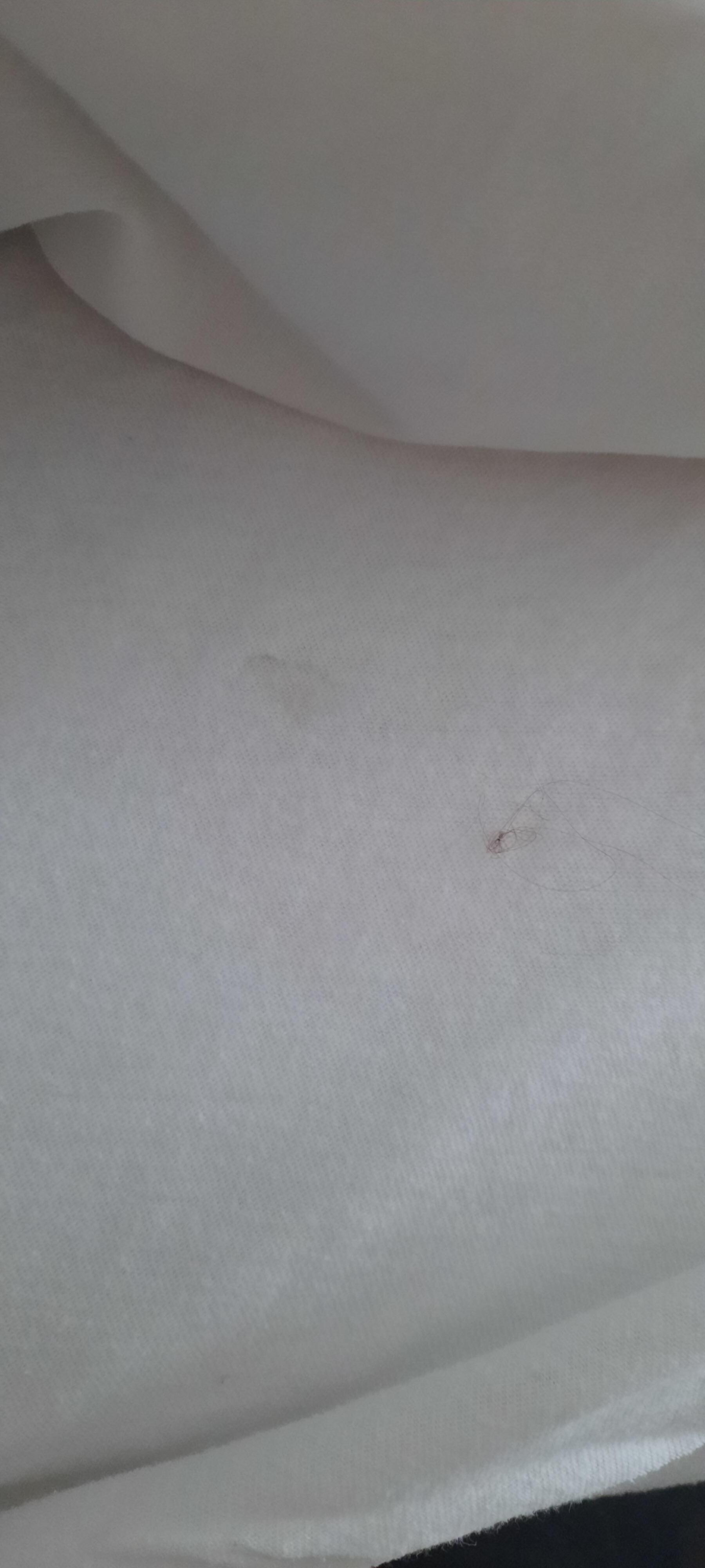 Flecken und Haare im Bett