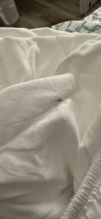 Hair clumps on the bedding