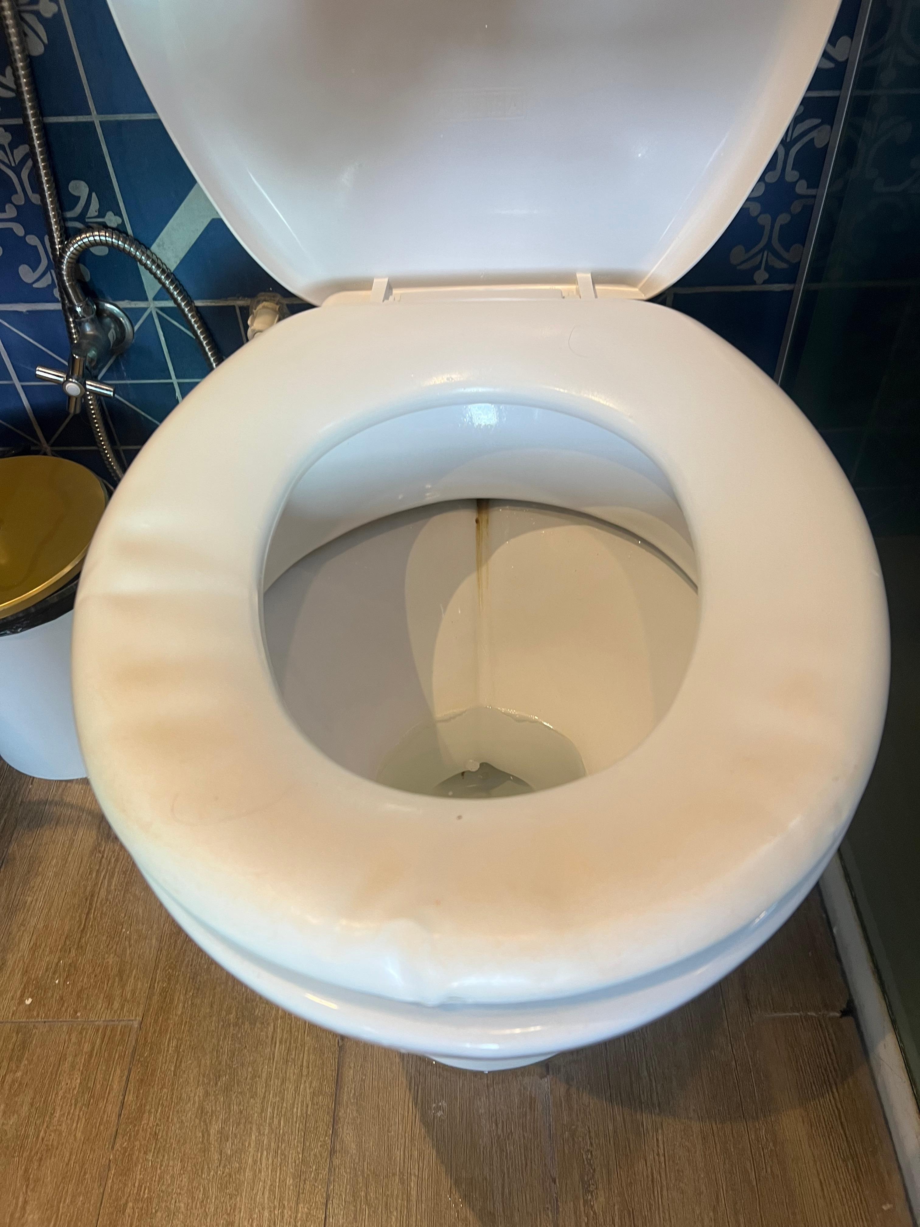 Assento velho e encardido 