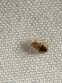 One of many bed bugs on the bed