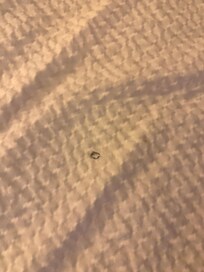 Cigarettes burns on comforter