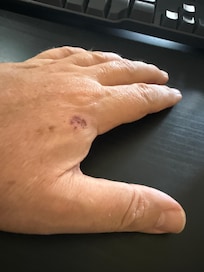 Bitten at night in the room!