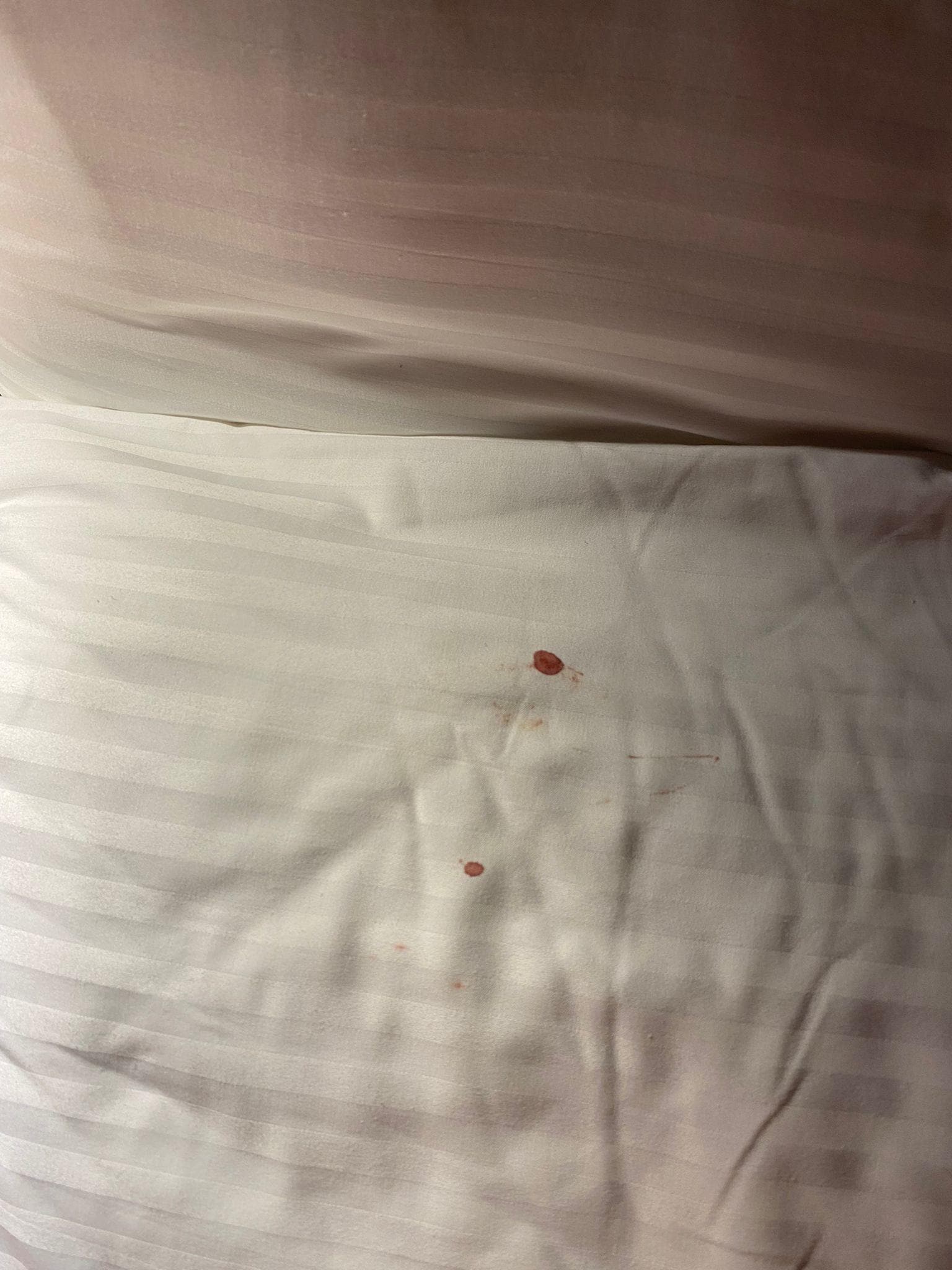 Poor cleanliness