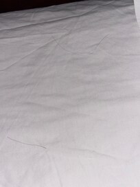 Some of many hairs which was not ours. Also there are stains on bed sheets.