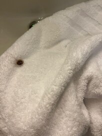 Hair on towels
