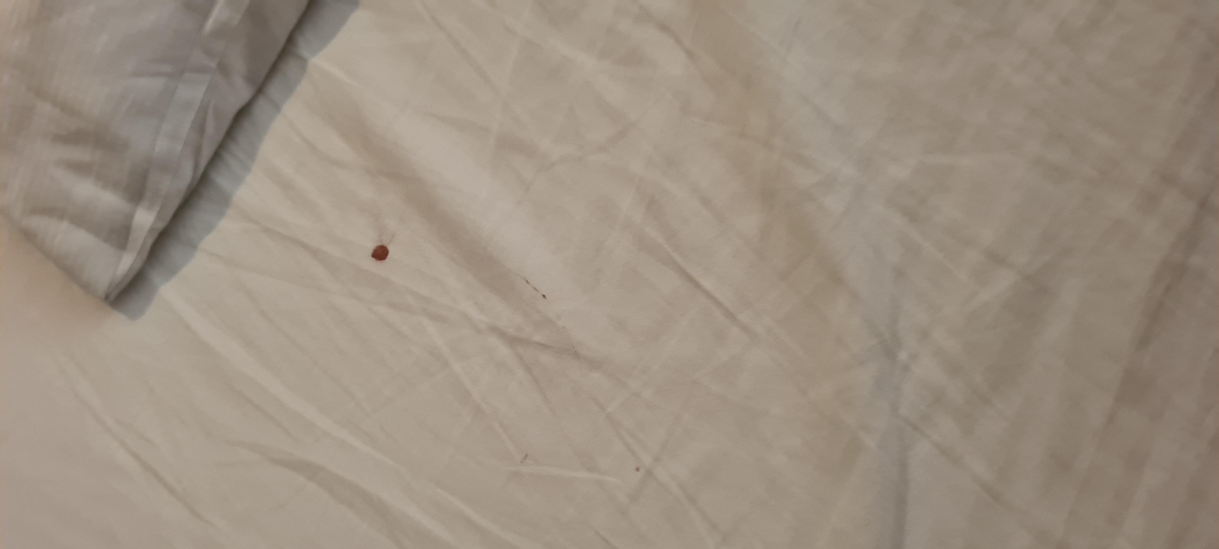 Das Blut von meiner tochter war 2 Tage im bett drin man musste sich beschweren das mal was geputzt wurde