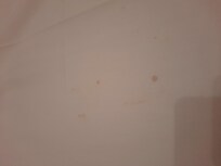 Pequenas manchas visibles al retirar la sabana superior.