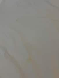 Multiple yellow stains on the bed sheet
