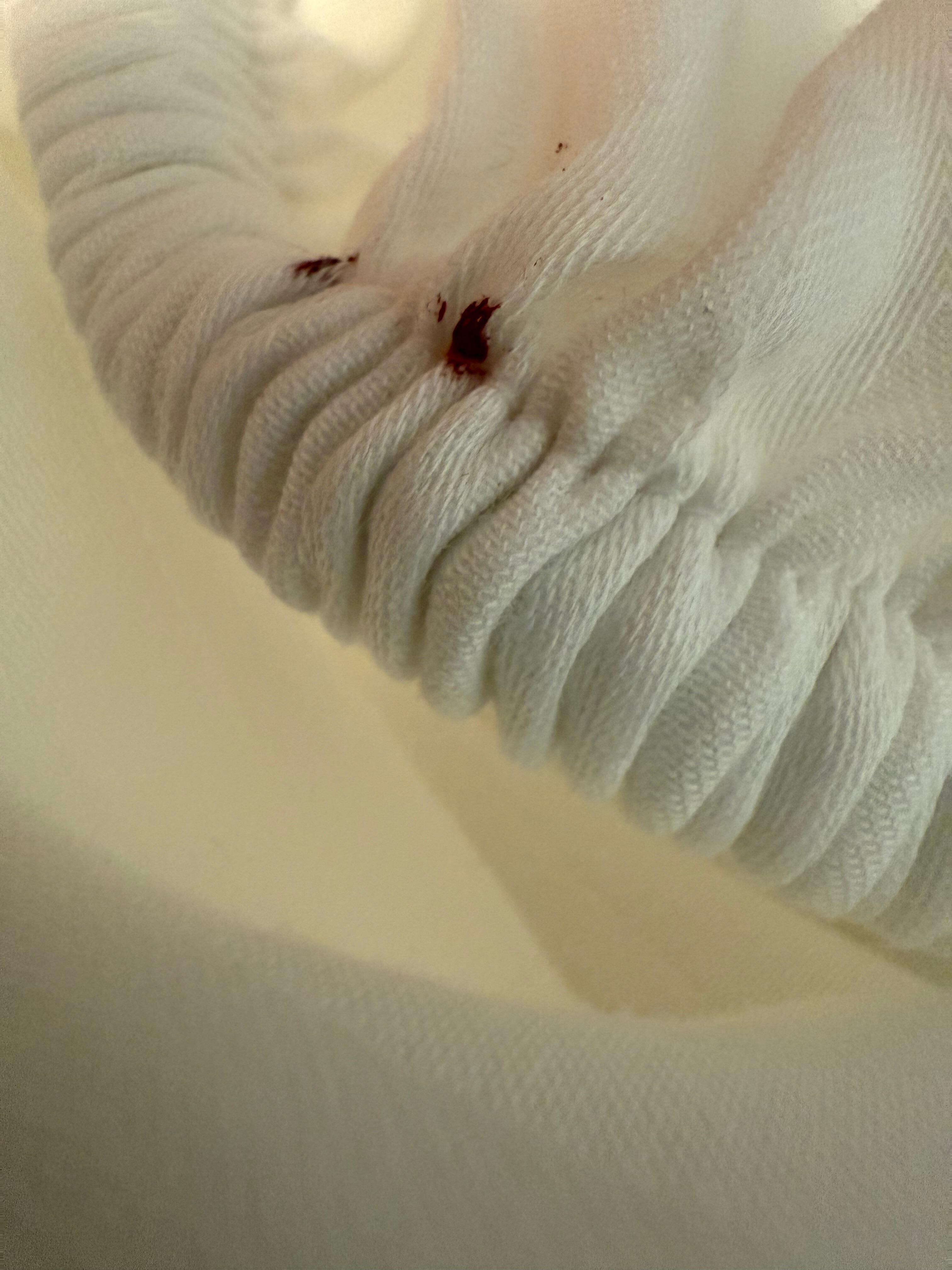 Bed bugs