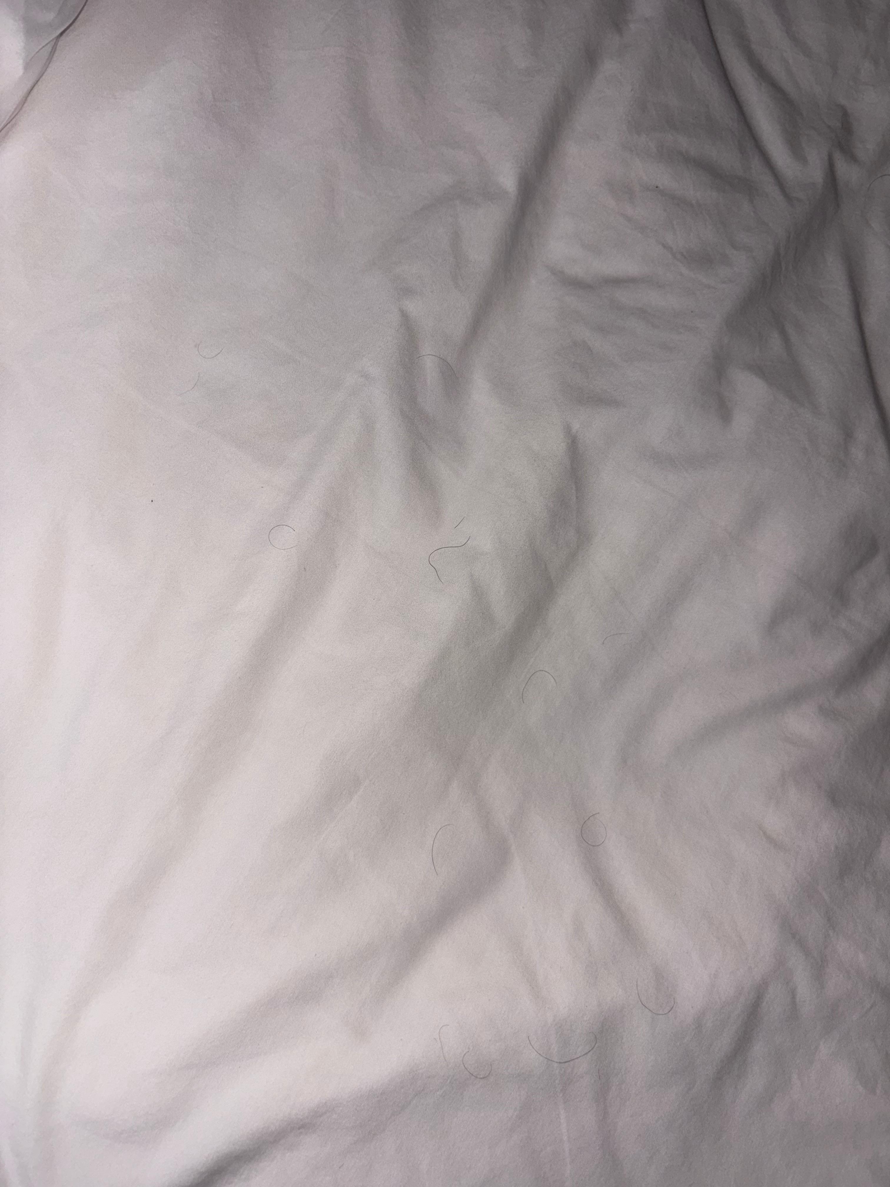 Some of the many black hairs on the bed. 